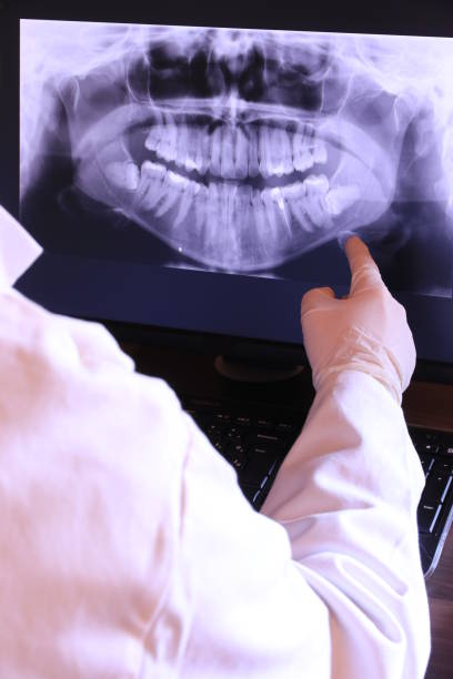 Best Chipped Tooth Repair Near Me  in Wadsworth, OH