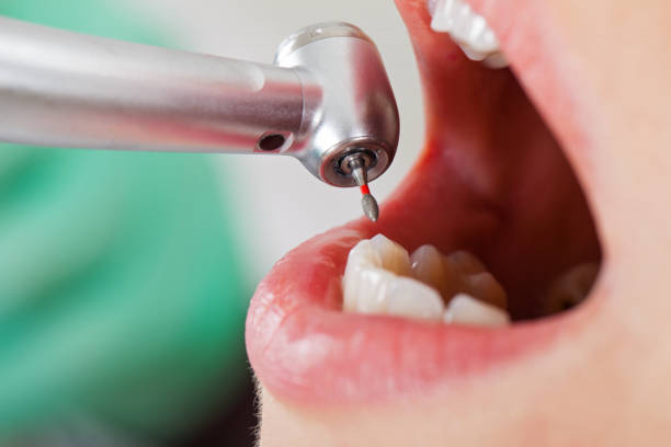 Best Cracked Tooth Emergency Dentist  in Wadsworth, OH